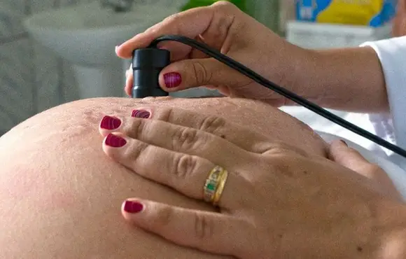 Teste para HTLV passa a ser indicado para gestantes durante pré-natal